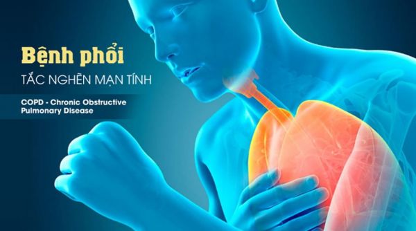 Điều Trị Bệnh Phổi Tắc Nghẽn Mãn Tính - COPD Từ Đông Y